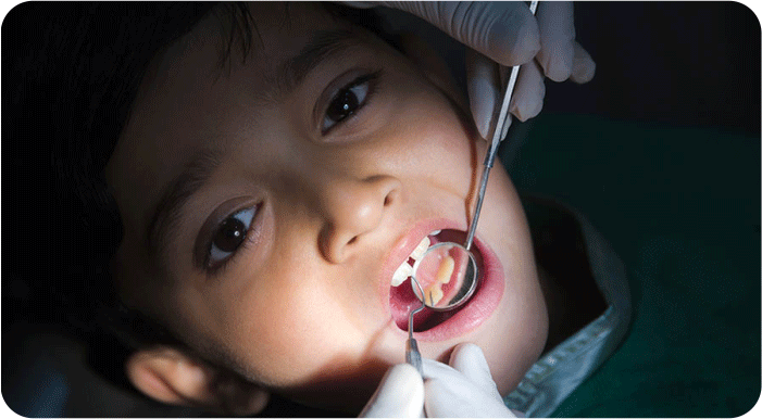 Conservative Dentistry and Endodontics | Rungta Group of Colleges, Bhilai